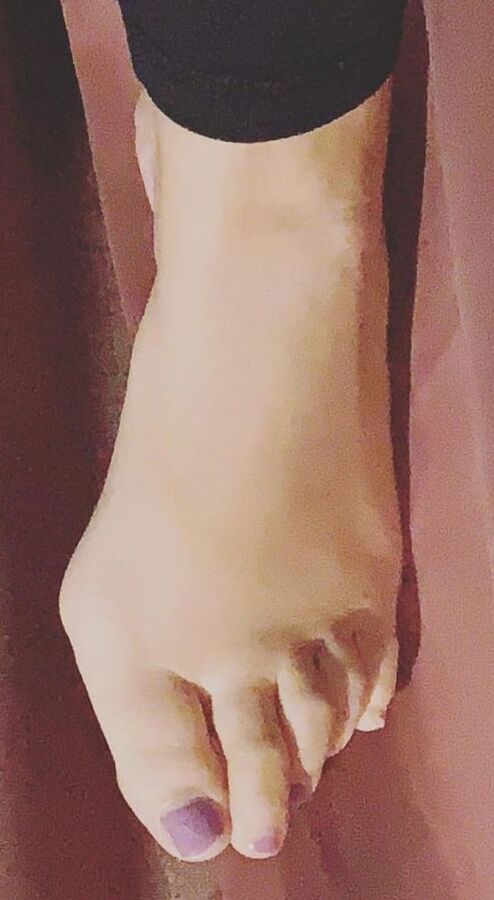 Beautiful bunions