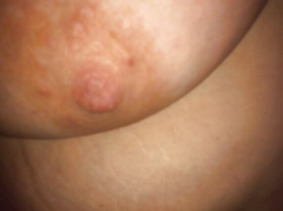 another bbw mummy from morobe