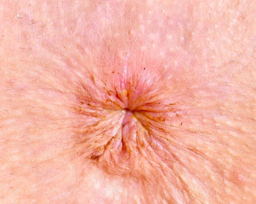 mix ass defonce