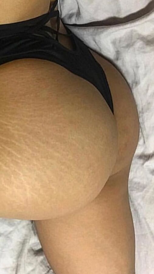 My Body