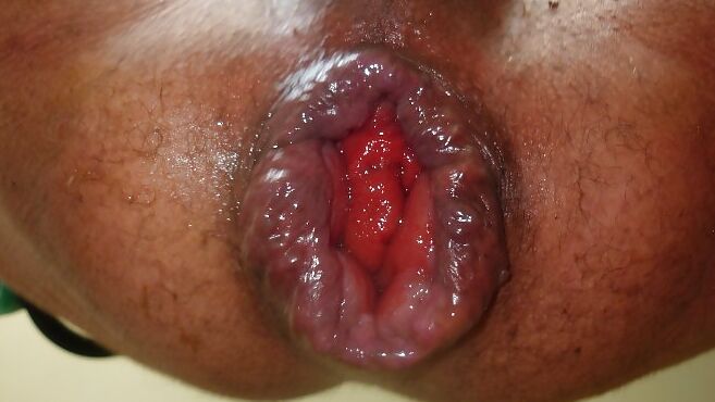 Cunt Lips