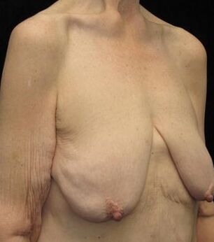 Saggy tits vol