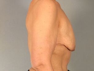 Saggy tits vol