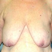 Saggy tits vol
