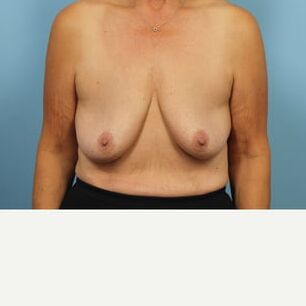 Saggy tits vol