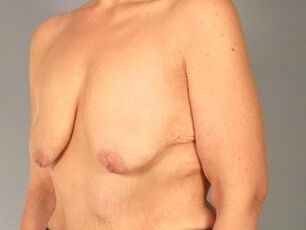 Saggy tits vol