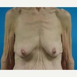 Saggy tits vol