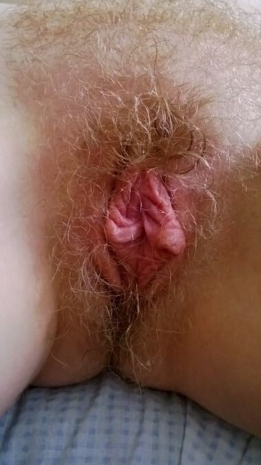 Hairy variety