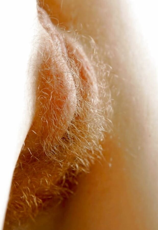 Hairy variety