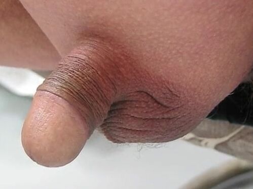 White dick power