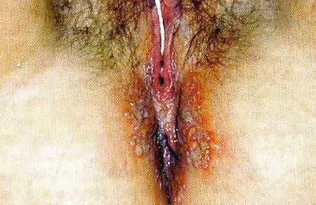 Gross fat pig Tiffany Soto