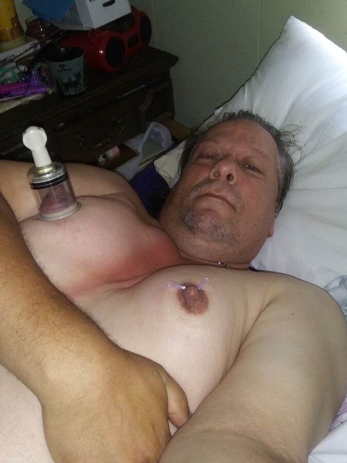 Needle nips