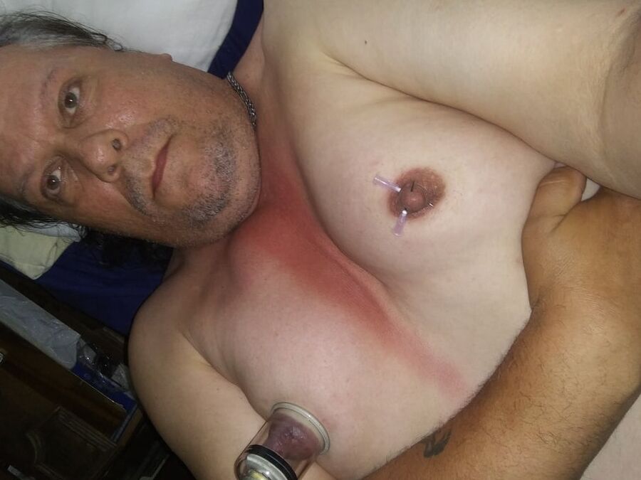 Needle nips