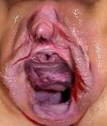 Gaping Cunt n Ass