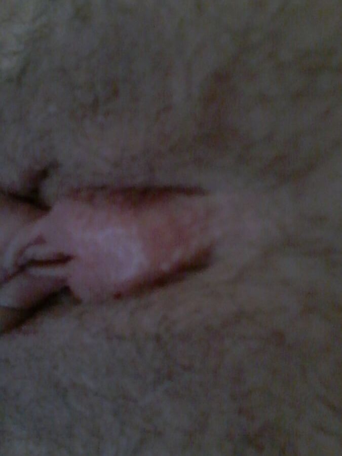 Clito pumping with seringue
