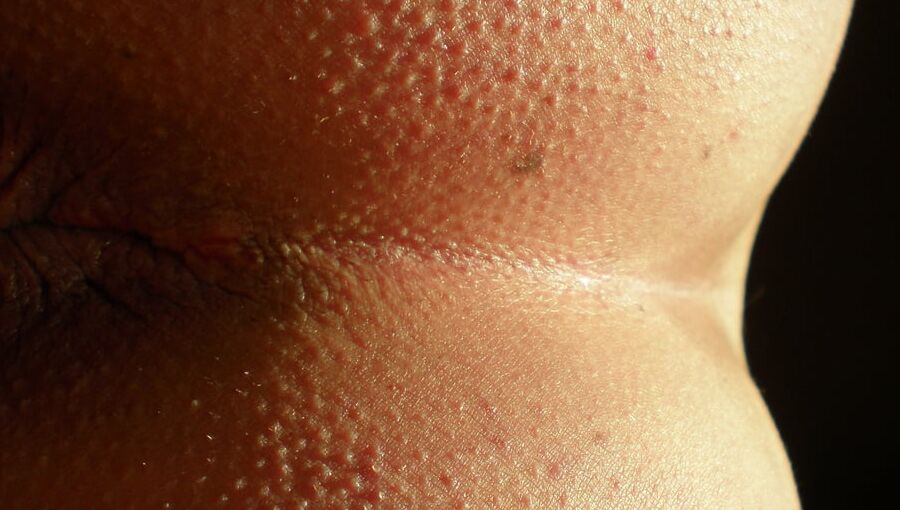 My yo horny butthole