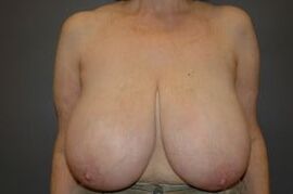 Huge mature Tits