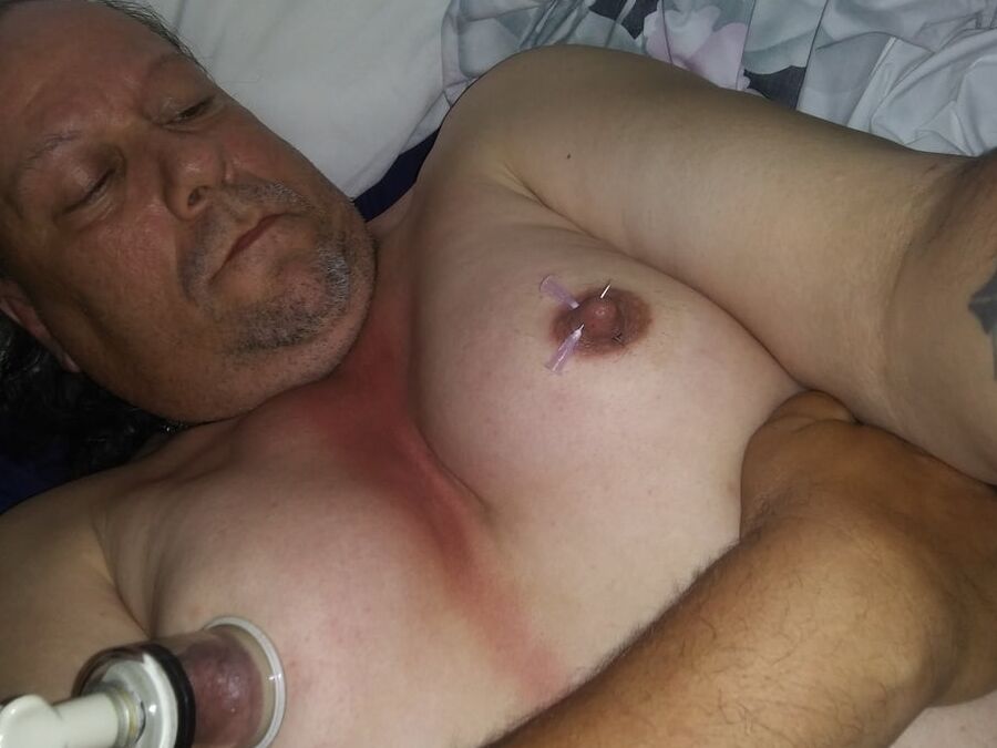 Needle nips