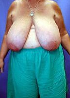 Huge mature Tits
