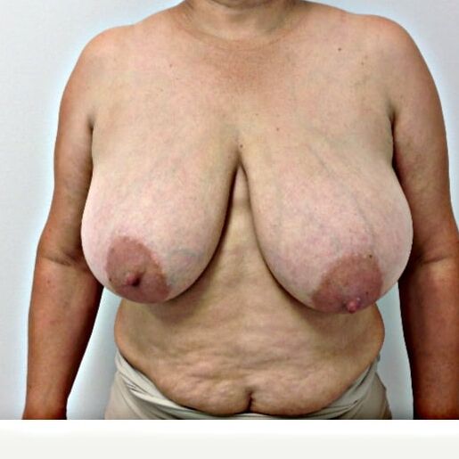 Huge mature Tits
