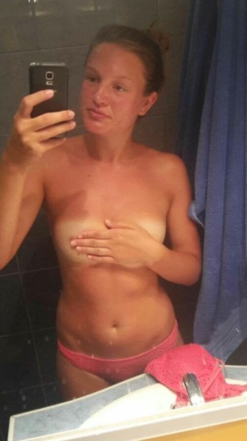 Randon sun burn women sunburn sunburnt pt