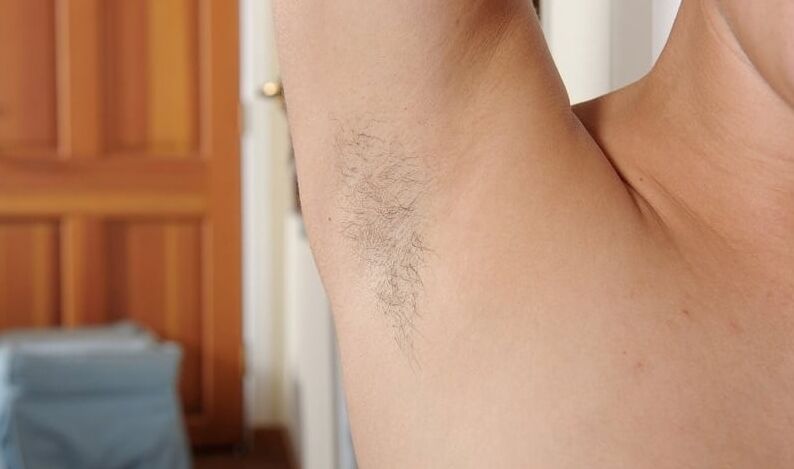 Hairy Brunette Amateur In Stockings