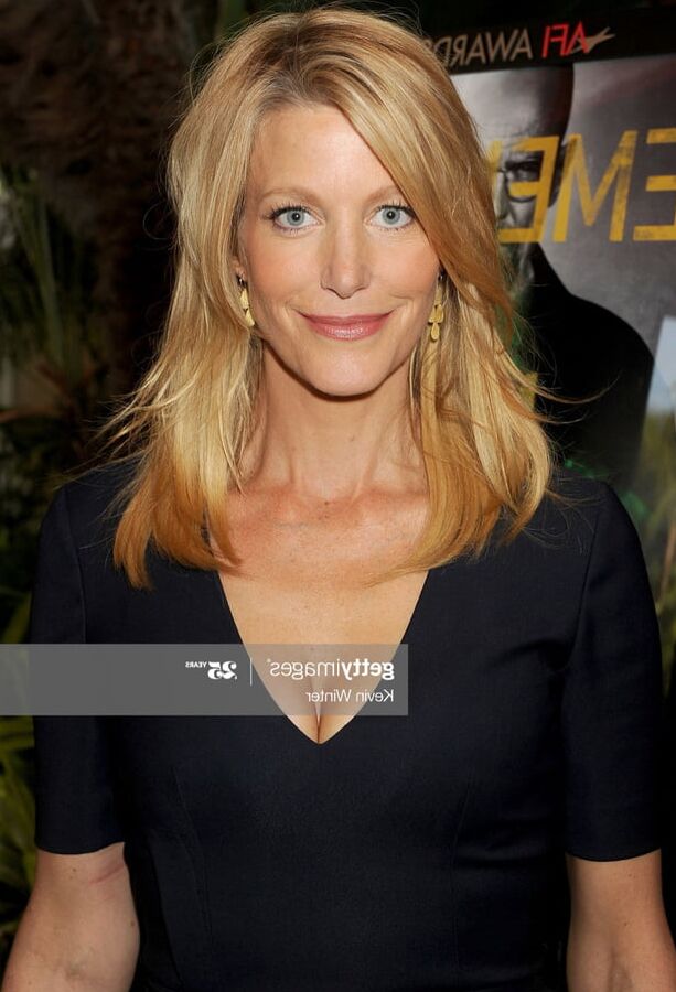 Anna Gunn
