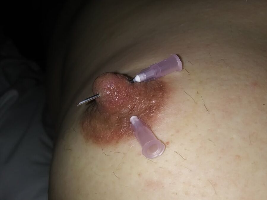 Needle nips