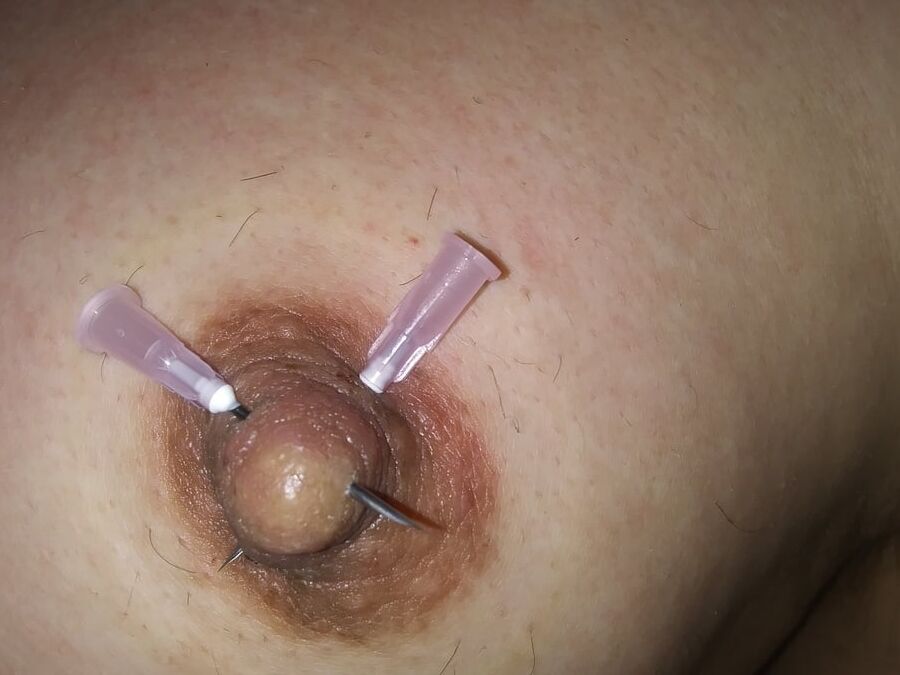 Needle nips