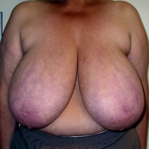 Huge mature Tits