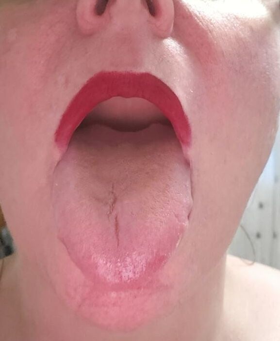 The Wife