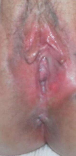 Hairy Webwhore