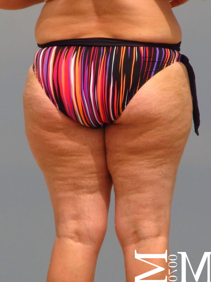 BIG ASS on the beach thongs (voyeur)