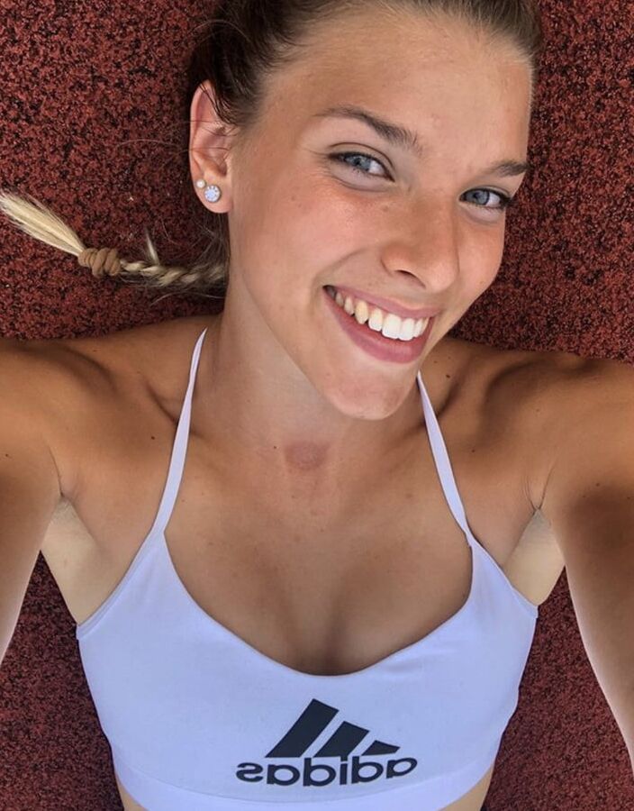 The freckles in the chest