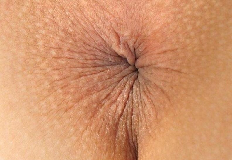 Cul...