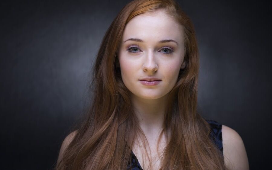 Sophie Turner&;s Facial Face