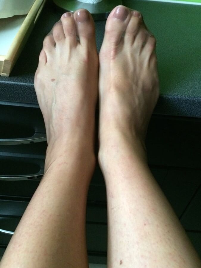 Nylonfeet IX