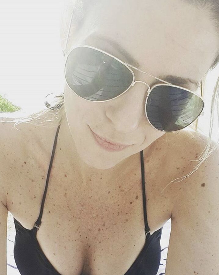 The freckles in the chest