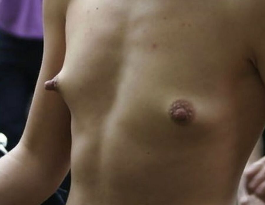 Breasts
