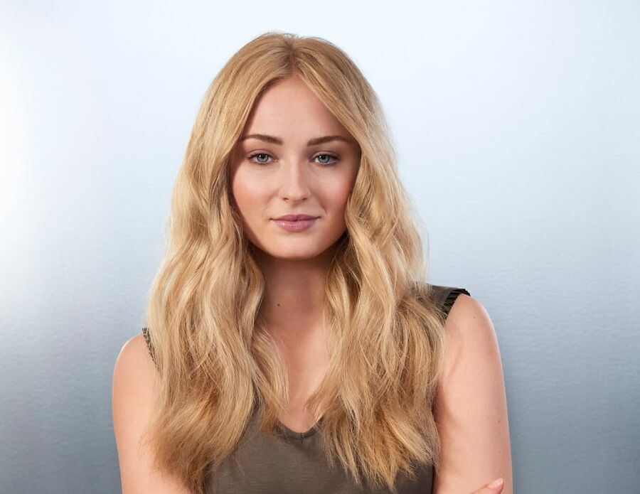 Sophie Turner&;s Facial Face
