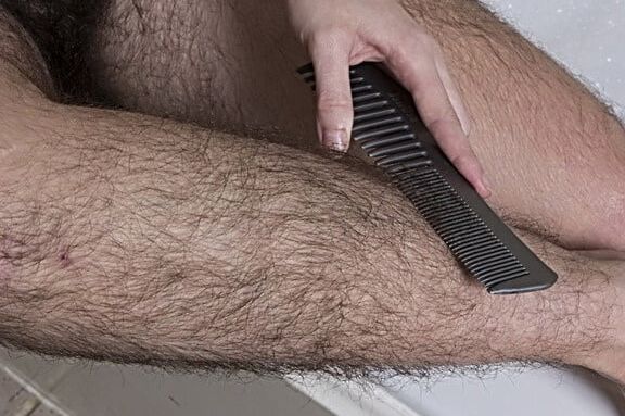 Hair, hair, everywhere