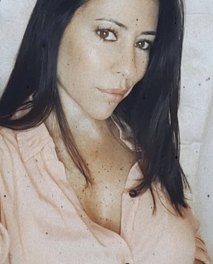 The freckles in the chest