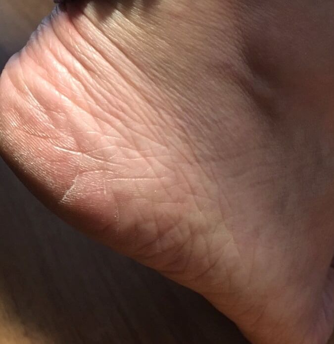 Friends sexy pics