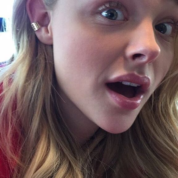 cutest mouths