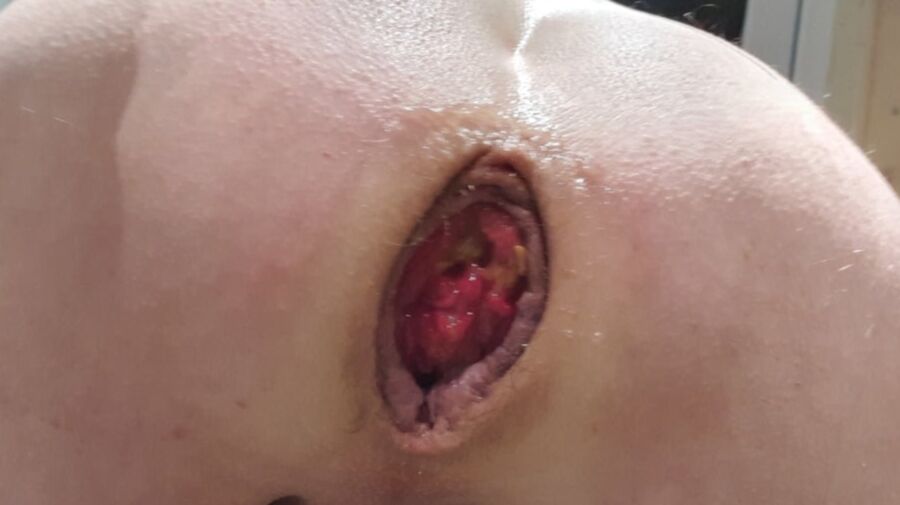 hole