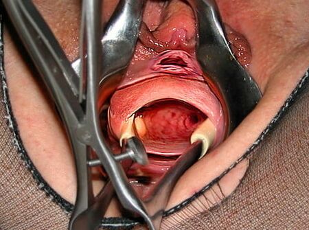 Gaping Holes