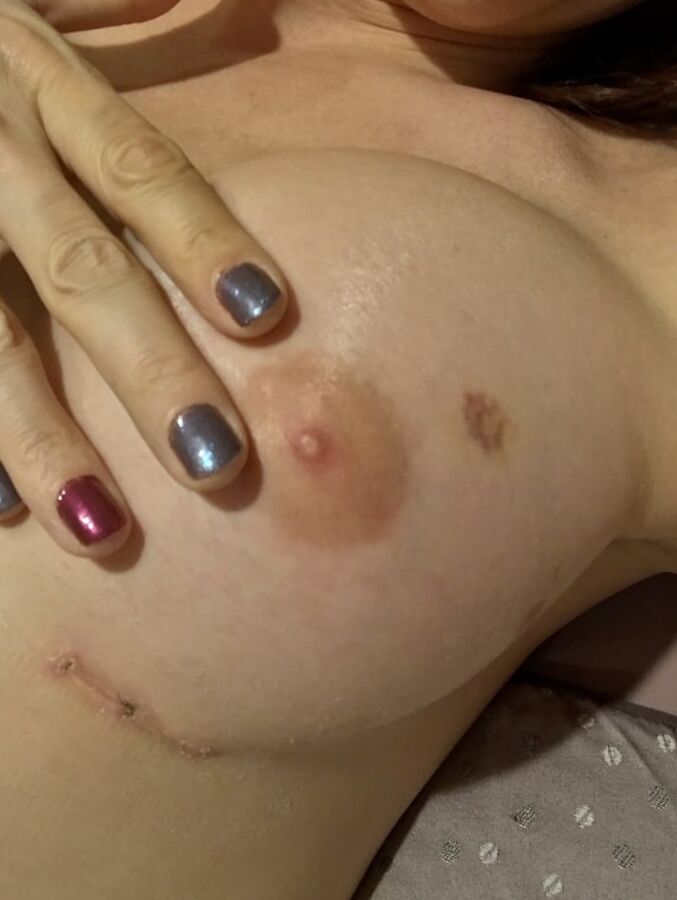 My new tits!!