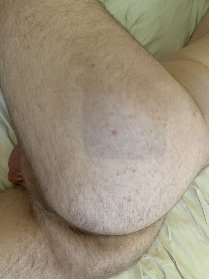 Ass and asshole