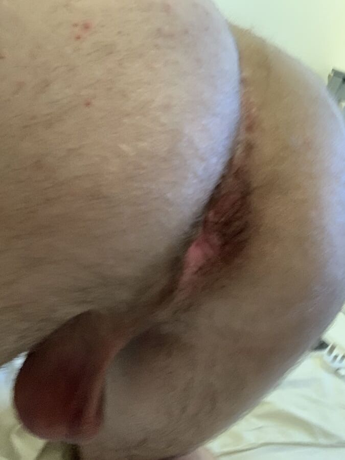 Ass and asshole