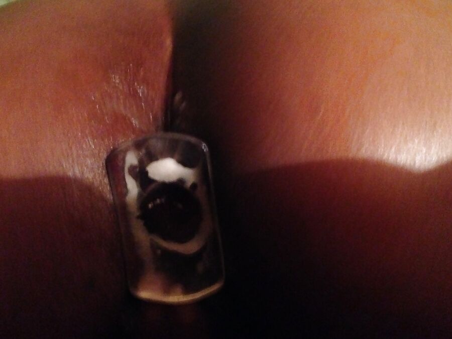 anal stretching and prolapse